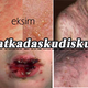 Illustration for article titled obat kadas tradisionalem/em